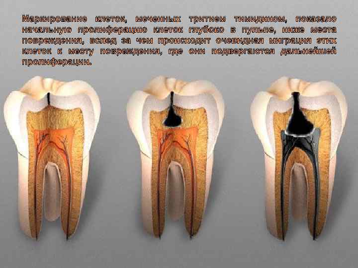 Маркирование клеток, меченных тритием тимидином, показало начальную пролиферацию клеток глубоко в пульпе, ниже места