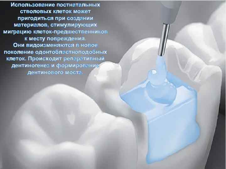 Использование постнатальных стволовых клеток может пригодиться при создании материалов, стимулирующих миграцию клеток-предшественников к месту