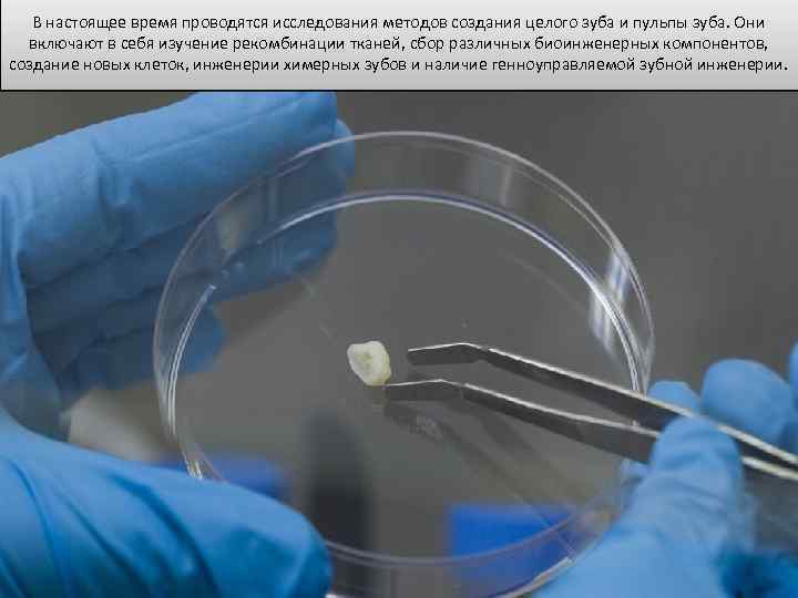 В настоящее время проводятся исследования методов создания целого зуба и пульпы зуба. Они включают