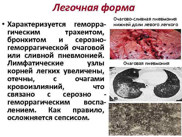 Легочная форма • Характеризуется геморрагическим трахеитом, бронхитом и серозногеморрагической очаговой или сливной пневмонией. Лимфатические
