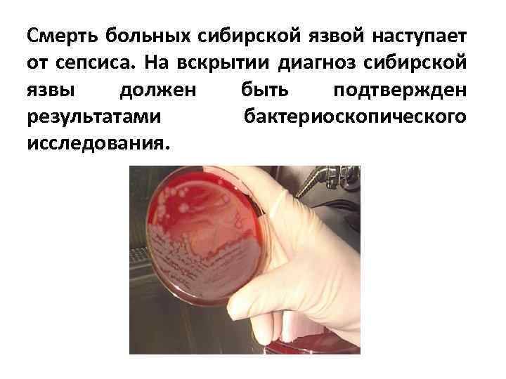 Смерть больных сибирской язвой наступает от сепсиса. На вскрытии диагноз сибирской язвы должен быть
