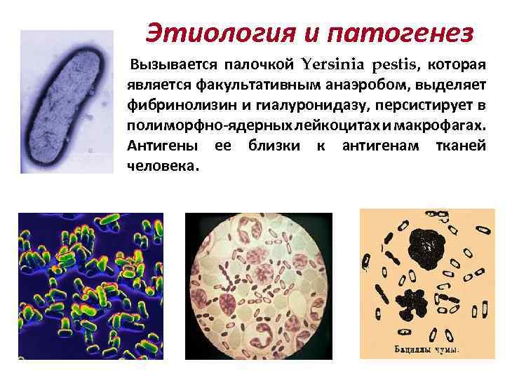 Этиология и патогенез Вызывается палочкой Yersinia pestis, которая является факультативным анаэробом, выделяет фибринолизин и