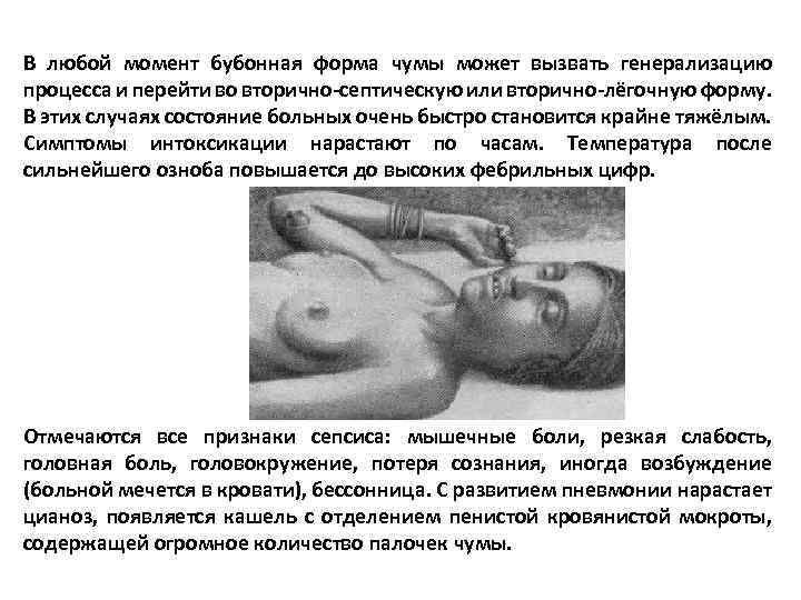 В любой момент бубонная форма чумы может вызвать генерализацию процесса и перейти во вторично-септическую