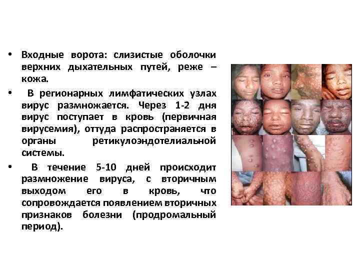  • Входные ворота: слизистые оболочки верхних дыхательных путей, реже – кожа. • В