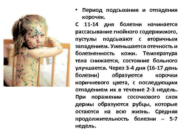  • Период подсыхания и отпадения корочек. С 11 -14 дня болезни начинается рассасывание