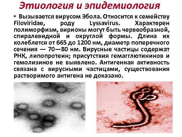 Этиология и эпидемиология • Вызывается вирусом Эбола. Относится к семейству Filoviridae, роду Lyssavirus. Характерен