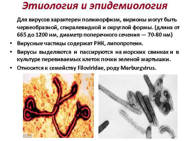 Этиология и эпидемиология Для вирусов характерен полиморфизм, вирионы могут быть червеобразной, спиралевидной и округлой