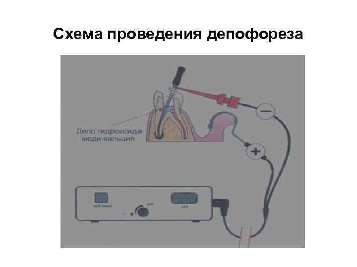 Схема проведения депофореза 