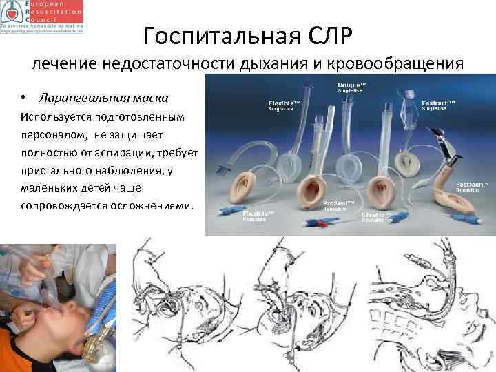 Госпитальная СЛР лечение недостаточности дыхания и кровообращения • Ларингеальная маска Используется подготовленным персоналом, не