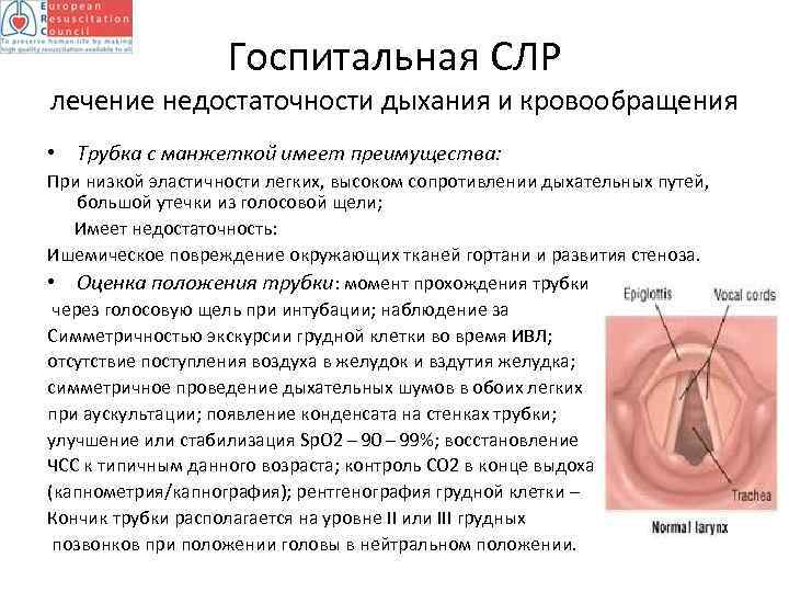 Госпитальная СЛР лечение недостаточности дыхания и кровообращения • Трубка с манжеткой имеет преимущества: При