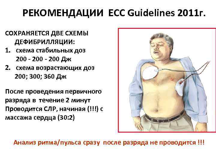 РЕКОМЕНДАЦИИ ECC Guidelines 2011 г. СОХРАНЯЕТСЯ ДВЕ СХЕМЫ ДЕФИБРИЛЛЯЦИИ: 1. схема стабильных доз 200