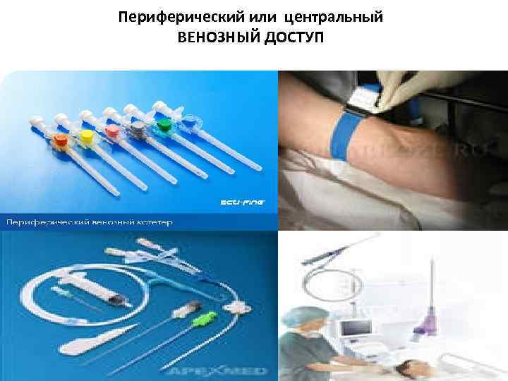 Периферический или центральный ВЕНОЗНЫЙ ДОСТУП 