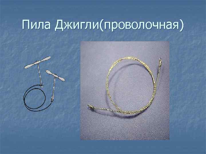   Виды  молотков n  а — малый хирургический молоток с двусторонним