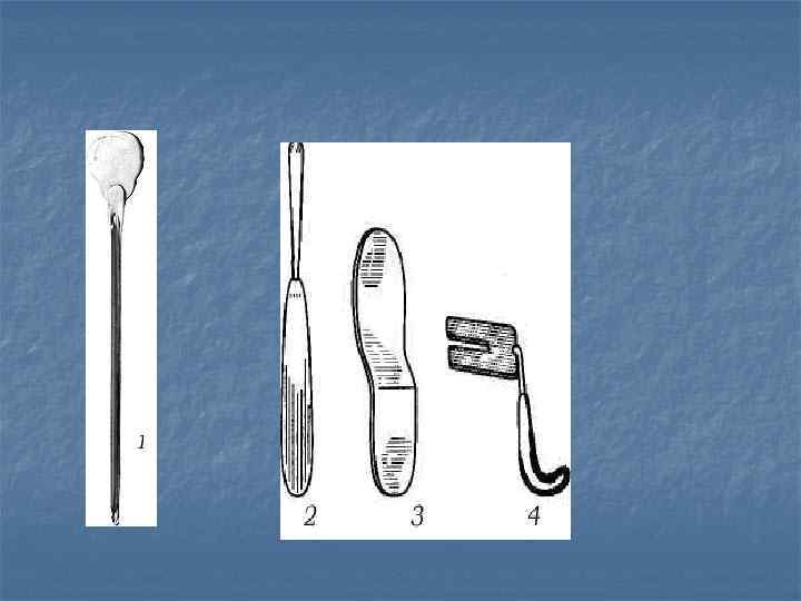 n  1— 4 — острый и тупые крючки;  n  5— 7