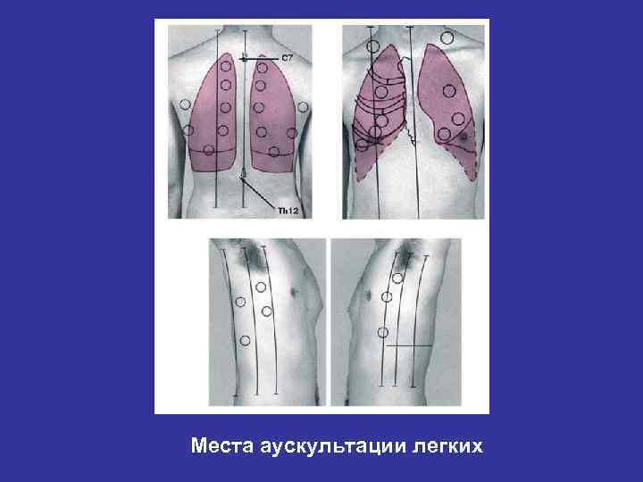 Места аускультации легких 