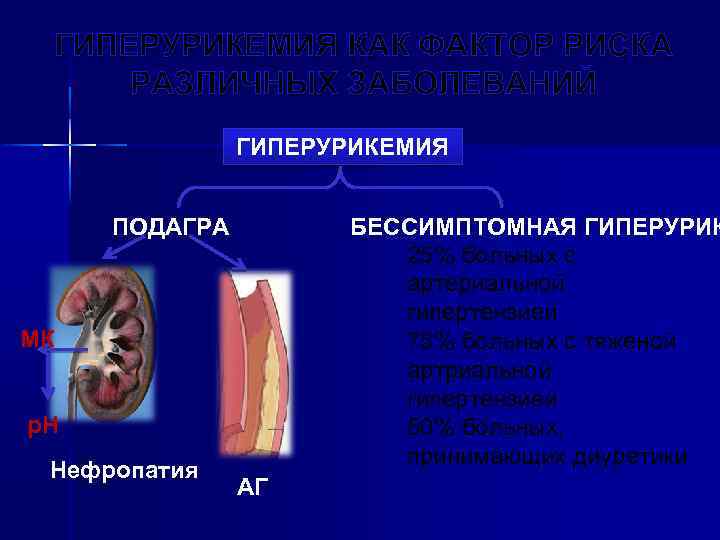 ГИПЕРУРИКЕМИЯ КАК ФАКТОР РИСКА РАЗЛИЧНЫХ ЗАБОЛЕВАНИЙ ГИПЕРУРИКЕМИЯ ПОДАГРА БЕССИМПТОМНАЯ ГИПЕРУРИК 25% больных с артериальной