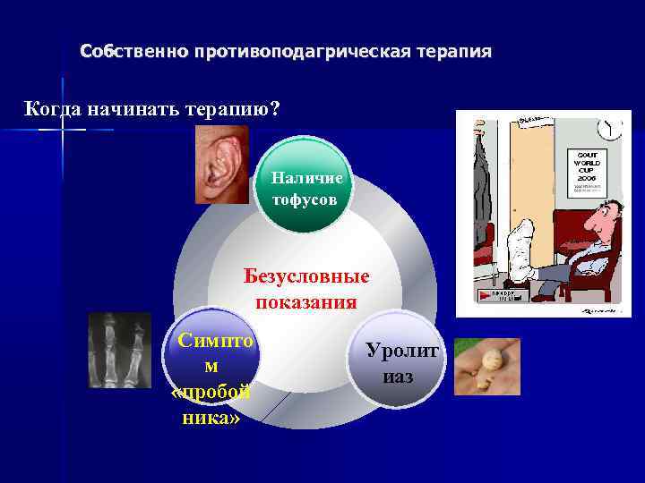 Собственно противоподагрическая терапия Когда начинать терапию? Наличие тофусов Безусловные показания Симпто м «пробой ника»