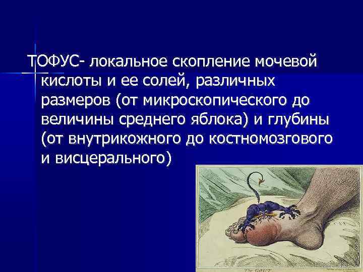 ТОФУС- локальное скопление мочевой кислоты и ее солей, различных размеров (от микроскопического до величины