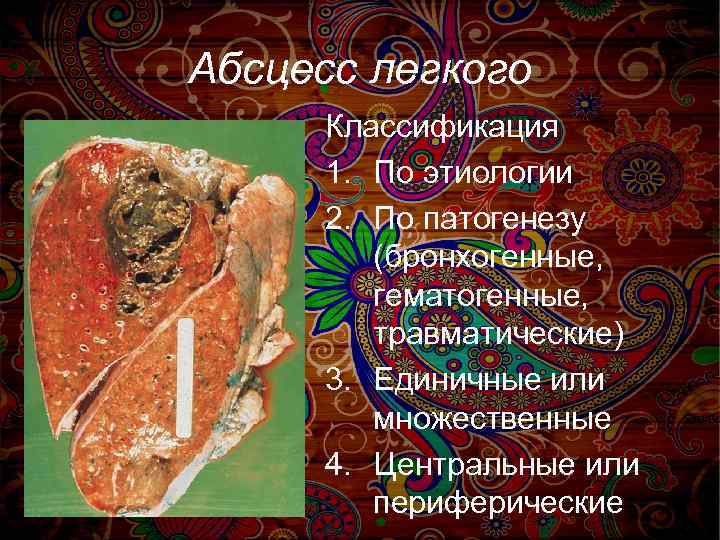 Абсцесс легкого Классификация 1. По этиологии 2. По патогенезу (бронхогенные, гематогенные, травматические) 3. Единичные