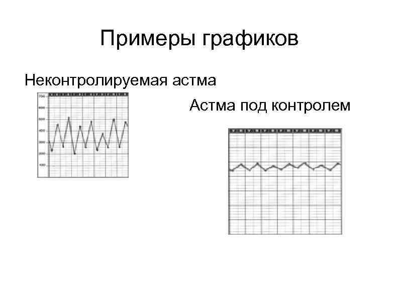 Примеры графиков Неконтролируемая астма Астма под контролем 