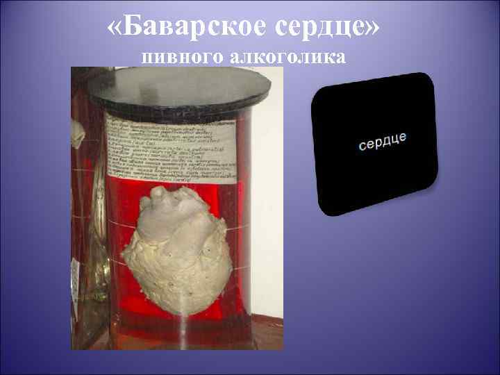  «Баварское сердце» пивного алкоголика 
