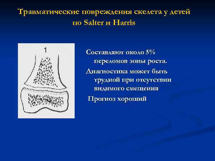 Травматические повреждения скелета у детей по Salter и Harris Составляют около 5% переломов зоны