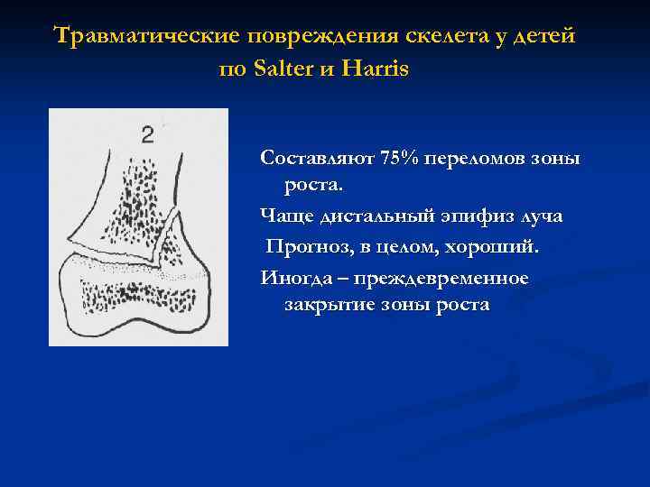 Травматические повреждения скелета у детей по Salter и Harris Составляют 75% переломов зоны роста.