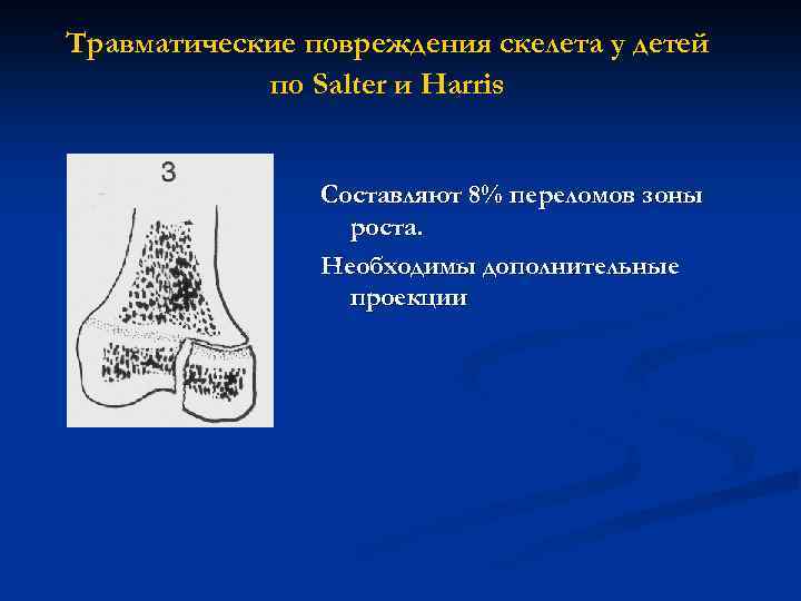 Травматические повреждения скелета у детей по Salter и Harris Составляют 8% переломов зоны роста.