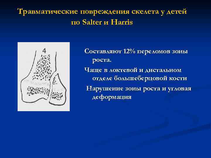 Травматические повреждения скелета у детей по Salter и Harris Составляют 12% переломов зоны роста.