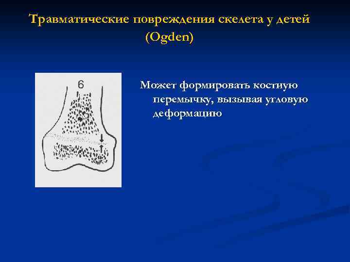 Травматические повреждения скелета у детей (Ogden) Может формировать костную перемычку, вызывая угловую деформацию 
