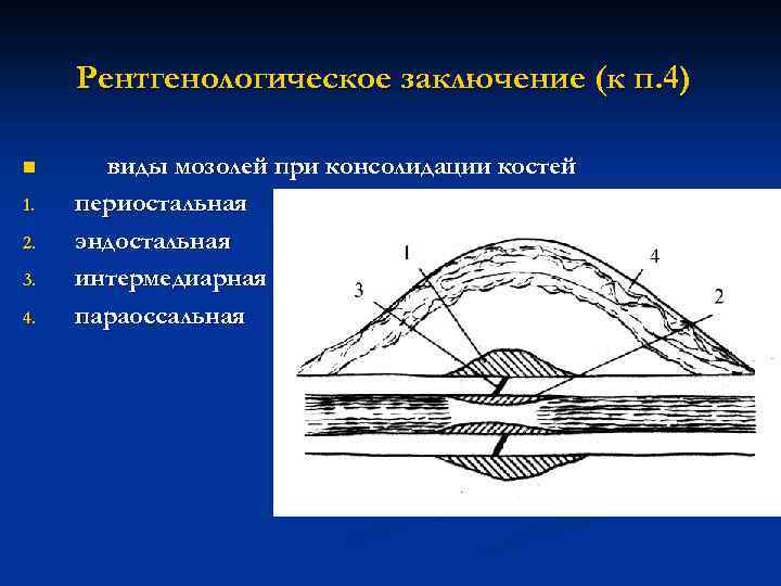 Рентгенологическое заключение (к п. 4) n 1. 2. 3. 4. виды мозолей при консолидации
