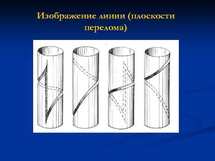 Изображение линии (плоскости перелома) 