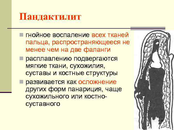Пандактилит n гнойное воспаление всех тканей пальца, распространяющееся не менее чем на две фаланги