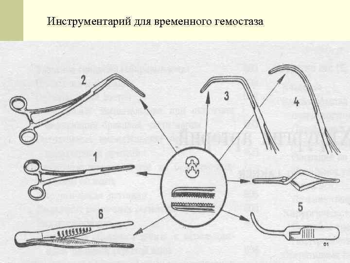 Инструментарий для временного гемостаза 61 