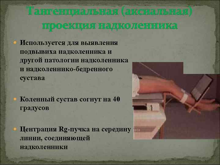 Тангенциальная (аксиальная) проекция надколенника Используется для выявления подвывиха надколенника и другой патологии надколенника и