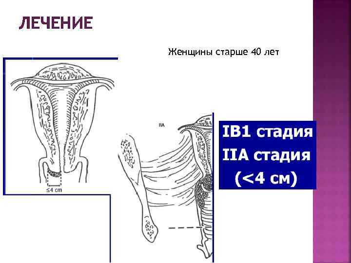 ЛЕЧЕНИЕ Женщины старше 40 лет 
