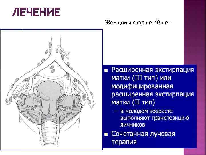 ЛЕЧЕНИЕ Женщины старше 40 лет 