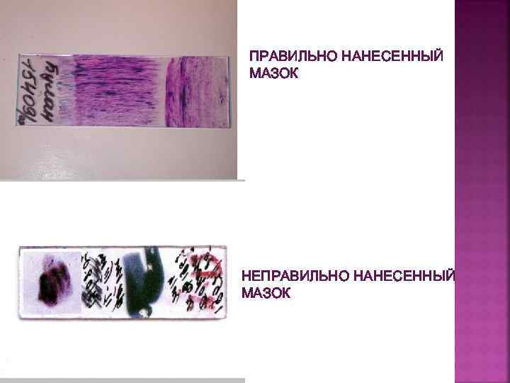 ПРАВИЛЬНО НАНЕСЕННЫЙ МАЗОК НЕПРАВИЛЬНО НАНЕСЕННЫЙ МАЗОК 