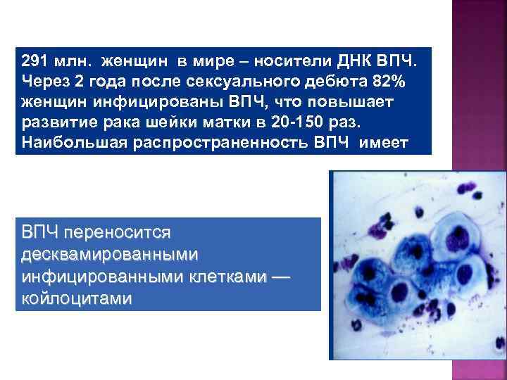 291 млн. женщин в мире – носители ДНК ВПЧ. Через 2 года после сексуального