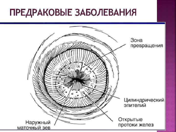 ПРЕДРАКОВЫЕ ЗАБОЛЕВАНИЯ 