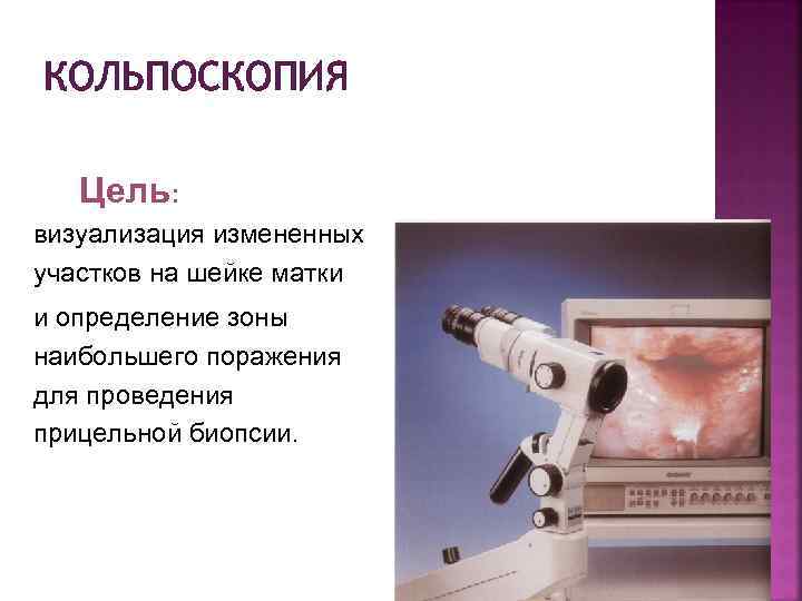 КОЛЬПОСКОПИЯ Цель: визуализация измененных участков на шейке матки и определение зоны наибольшего поражения для