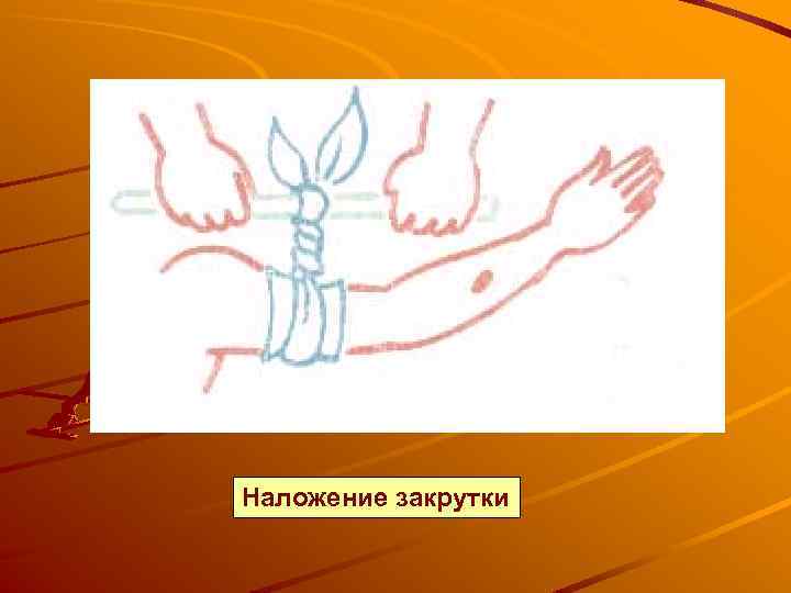 Наложение закрутки 