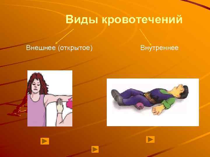 Виды кровотечений Внешнее (открытое) Внутреннее 