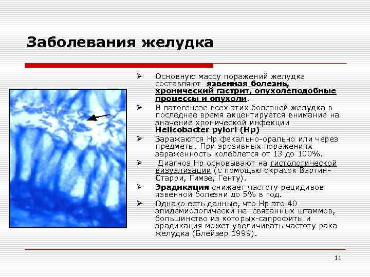 Заболевания желудка Ø Ø Ø Основную массу поражений желудка составляют язвенная болезнь, хронический гастрит,