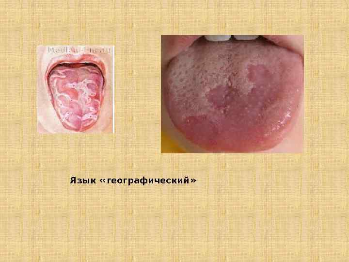 Язык «географический» 