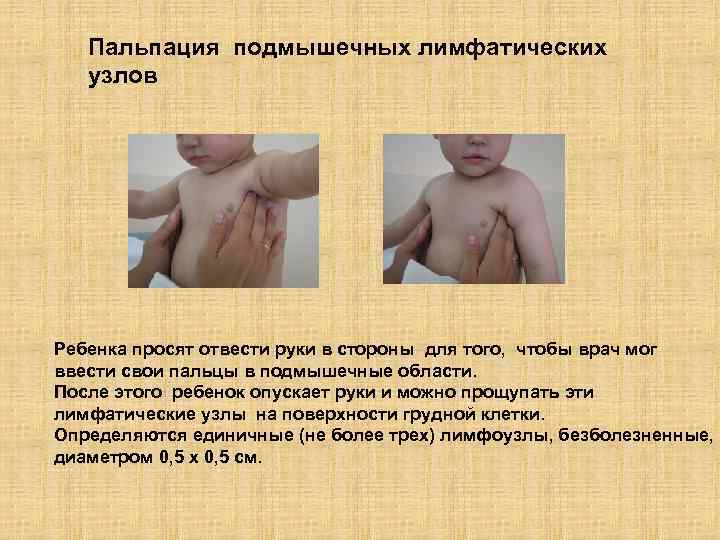 Пальпация подмышечных лимфатических узлов Ребенка просят отвести руки в стороны для того, чтобы врач