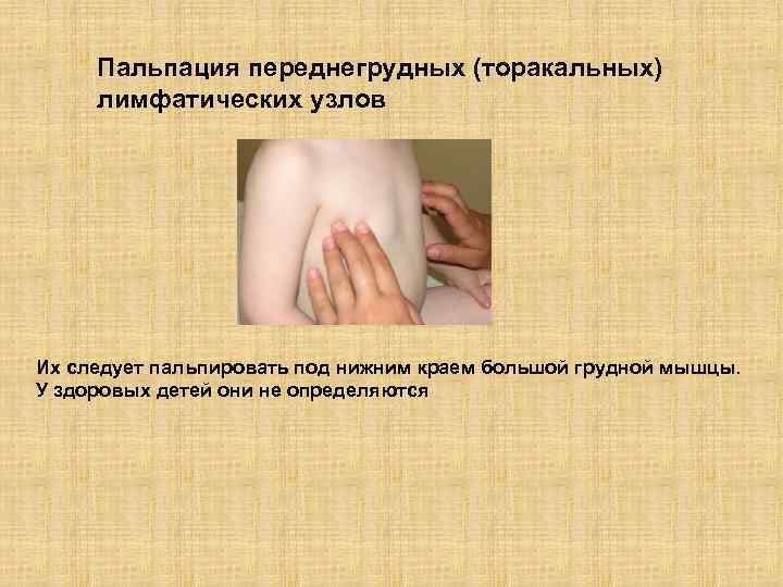 Пальпация переднегрудных (торакальных) лимфатических узлов Их следует пальпировать под нижним краем большой грудной мышцы.