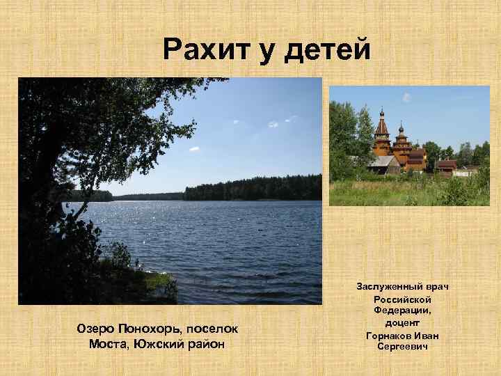 Рахит у детей Озеро Понохорь, поселок Моста, Южский район Заслуженный врач Российской Федерации, доцент