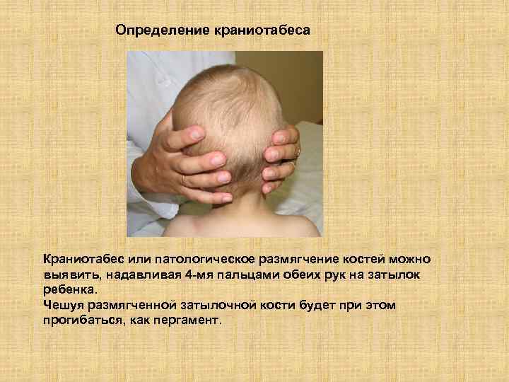 Определение краниотабеса Краниотабес или патологическое размягчение костей можно выявить, надавливая 4 -мя пальцами обеих