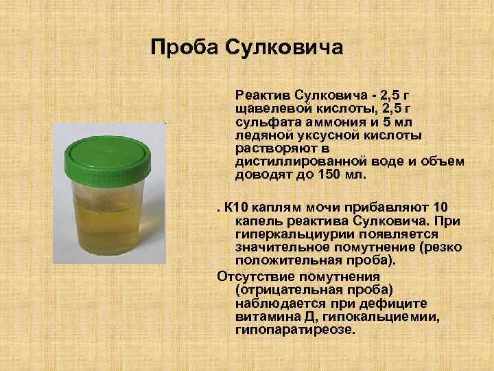Проба Сулковича Реактив Сулковича - 2, 5 г щавелевой кислоты, 2, 5 г сульфата